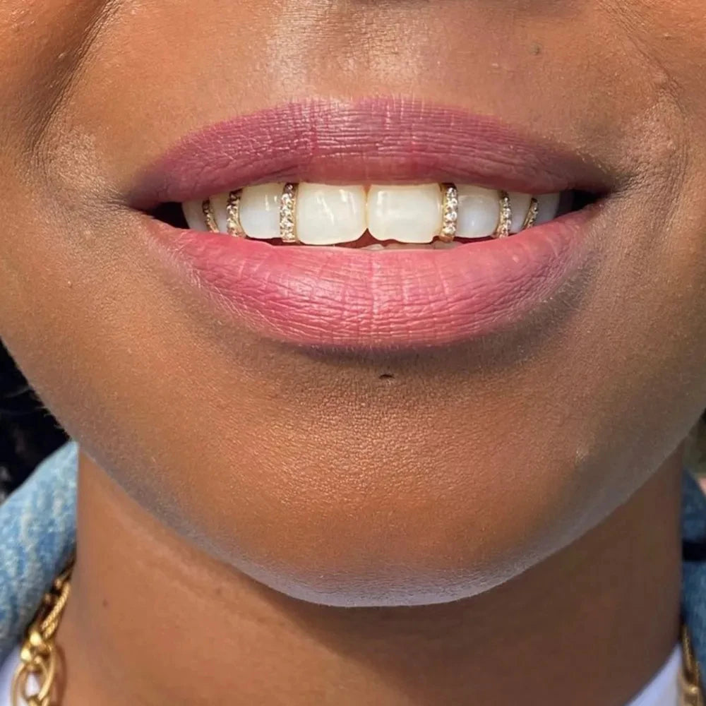 Tooth Grillz in Silver and Gold | Urban Grillz 