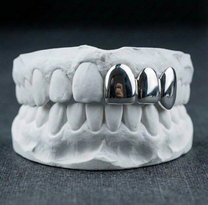 Custom Classic Teeth Grillz